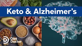 Keto helps with symptoms of Alzheimer's disease