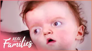 Apert Syndrome Baby Has Excess Brain Fluids | Little Miracles S3E23 | Real Families