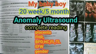 /2d/4d/level 2 ultrasound  sonography complete Reading#babyboy