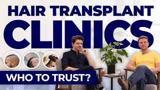 Hair Transplant Clinics: Who To Trust?