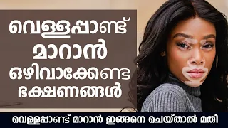 വെള്ളപ്പാണ്ട് മാറാൻ ഇങ്ങനെ ചെയ്താൽ മതി | Vitiligo Treatment Malayalam