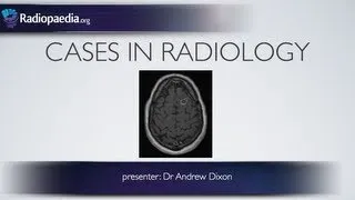 Cases in Radiology: Episode 1 (neuroradiology, CT, MRI)