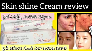 Skin shine Cream In Telugu  Uses SideEffects How To Apply Precautions etc