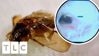 Man Has A Bug Stuck In His EAR!! | Stuck