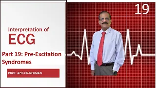 ECG Part 19: Pre Excitation Syndromes