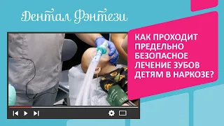 🧑‍⚕️ Как проходит предельно безопасное лечение зубов детям в наркозе?