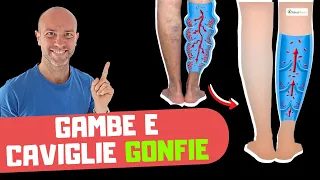 Il modo più rapido, facile e sicuro per curare le GAMBE GONFIE