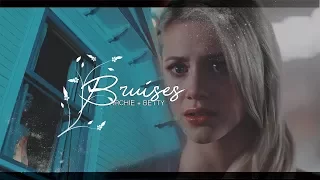 Archie + Betty I Bruises {2x08}