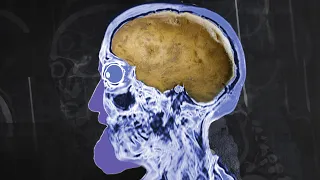 A Prisoner Had 2 Week Old Baked Potato For Dinner. This Is What Happened To His Brain.