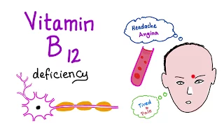 Vitamin B12 (Cobalamin) Deficiency (Causes, Symptoms, Diagnosis & Management)