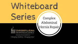 Complex Abdominal Hernia Repair – Component Separation