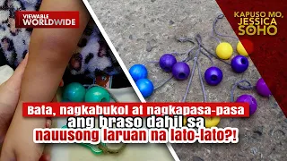 Bata, nagkapasa-pasa ang braso dahil sa laruan na lato lato?! | Kapuso Mo, Jessica Soho