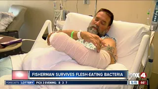 Fisherman survives flesh-eating bacteria