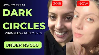 Best Eye Creams Under 500 Rs I Best Eye Cream for Dark Circles and Wrinkles in India