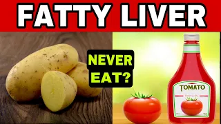 7 FORBIDDEN FOODS for FATTY LIVER and 11 Best Foods and Habits for Hepatic Steatosis