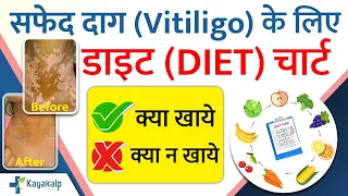 Vitiligo Diet Plan/Chart in Hindi | सफेद दाग | Vitiligo Foods to Eat & Avoid | Kayakalp Global