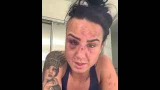 Ashlee Evans-Smith - UFC Vegas 15 Post-Fight Reaction // getting spine surgery on Dec. 14th