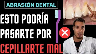 ABRASIÓN DENTAL - CEPILLARSE MAL puede DAÑAR tus DIENTES y ENCÍAS.