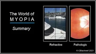 Myopia 6. Summary: World of Myopia