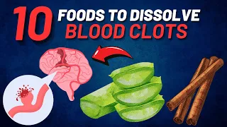 10 BEST Foods To DISSOLVE  Dangerous Blood Clots Naturally