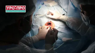 Лазерное лечение свища прямой кишки и гемороидопластика в клинике УРО-ПРО