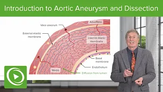 Introduction to Aortic Aneurysm and Dissection