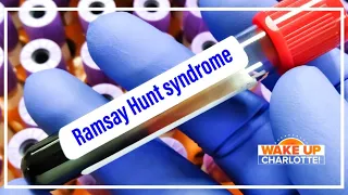 Ramsay Hunt syndrome; your questions answered