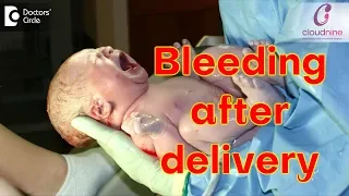 How long do I bleed after delivery? - Dr. Himani Sharma of Cloudnine Hospitals | Doctors’ Circle
