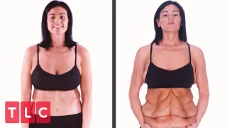 Incredible Skin Removal Transformations | Skin Tight