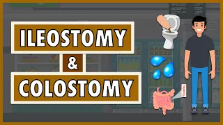 Ileostomy and Colostomy | Emphasis on Diet/Nutrition