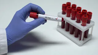 Dezembro Vermelho: mês de prevenção e conscientização sobre o HIV/Aids