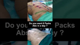 Six Pack Abs Surgery | Do you Want Six Pack Abs in a Day? | Plastic Surgery India