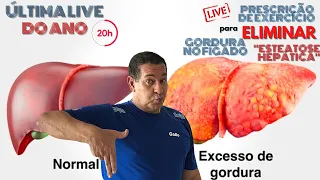 Prescrição de Exercício para ELIMINAR Gordura no Fígado, ''ESTEATOSE HEPÁTICA"!!