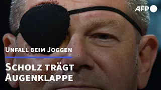 Kanzler mit Augenklappe | AFP