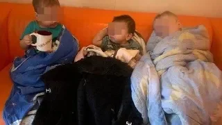 2-летняя девочка обгорела на диване на 70%
