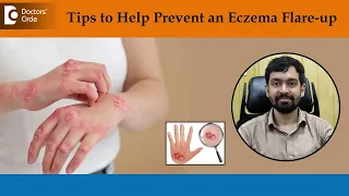 What Causes Eczema to Flare Up | How to Treat & Get Rid of Eczema-Dr.Rajdeep Mysore| Doctors' Circle