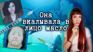 Она вкалывала себе в лицо соевое масло, герметик и цемент...