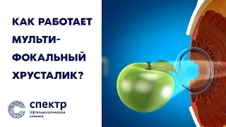 Как работает мультифокальный хрусталик? Хорошее зрение вблизи, вдаль и на среднем расстоянии.