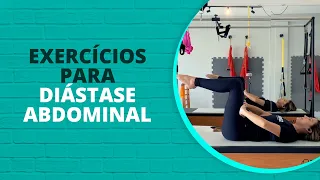 7 Exercícios para Diástase Abdominal