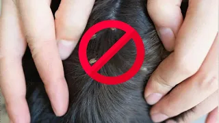 Ticks are afraid of this like FIRE! How to protect people and animals