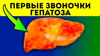 Врачи знают, но молчат! Первые симптомы гепатоза и как вылечить печень / гепатит