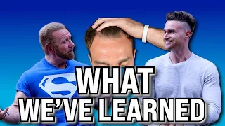 What have we learned after our Hair Transplants?! Ft. Bobby Dunlap