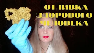 КАК ВЫГЛЯДИТ ОТЛИВКА ЗДОРОВОГО ЧЕЛОВЕКА