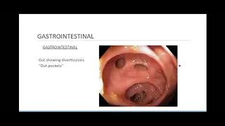 Brief Gastrointestinal/Genitourinary (GI/GU) Review for ALS Providers