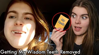 Wisdom Teeth Removal Reaction (this is the funniest I've ever been)