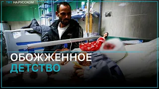 Палестинец борется за жизнь получившей глубокие ожоги 4-летеней дочери