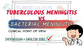 Tuberculous vs bacterial meningitis | Neuroaholics