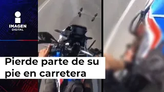 Por querer rebasar en carretera pierde parte del pie ¿irresponsable?