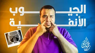 الجيوب الانفية | (تجربتي الشخصيه) | وكيف شفاني [الله] تعالى😍 (بدون أدوية) | بعد معاناة ٧ سنين🤕