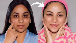 How I got rid of HYPERPIGMENTATION with this simple change to my routine!